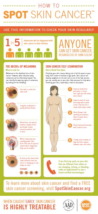 AmerAcacDerm.how-to-spot-skin-cancer-infographic-thumbnail