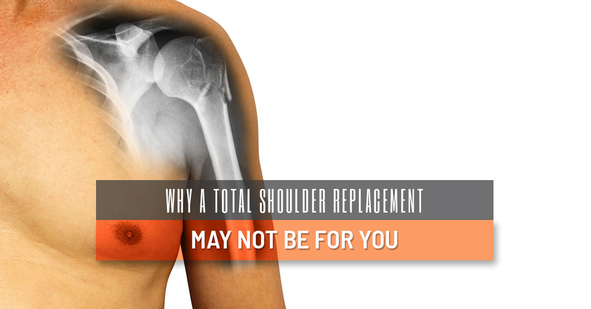 Shoulder Surgery Alternatives Columbus Why A Total Shoulder Replacement May Not Be For You