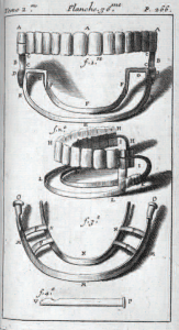 Diagram of dentures from Pierre Fauchard’s Le chirurgien dentiste ou traité des dent.