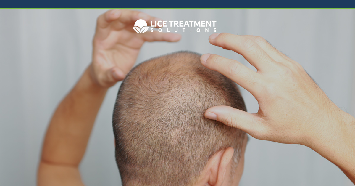 Head Lice Removal Everything You Need To Know About Lice In Texas