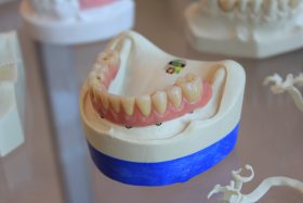 A pair of lower jaw dentures on a white scale rack. Photo by Quang Tri NGUYEN on Unsplash.