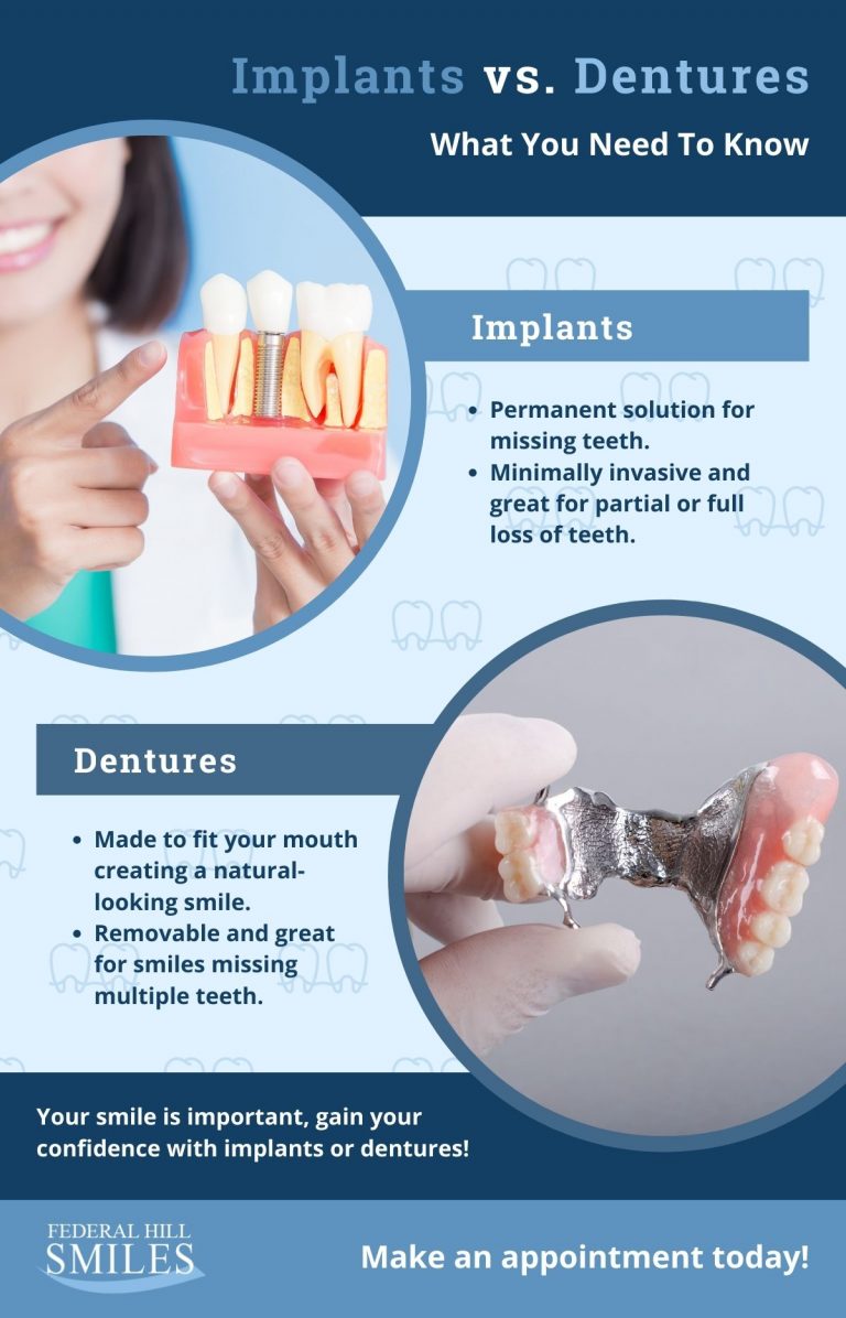 Implants vs. Dentures Infographic