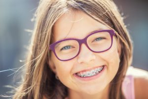 braces-2