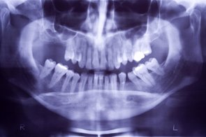 dentist-x-rays