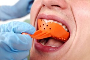 dentures-3