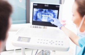 teeth cleaning arlington va 1