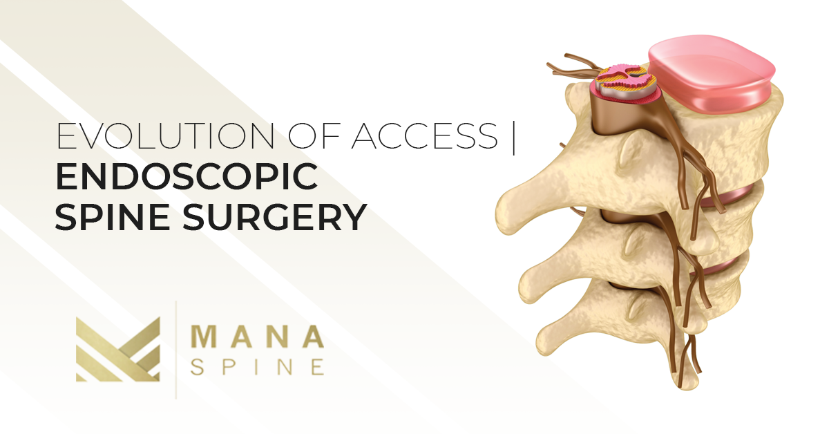 Minimally Invasive Spine Surgery Orlando Learn About Your Options