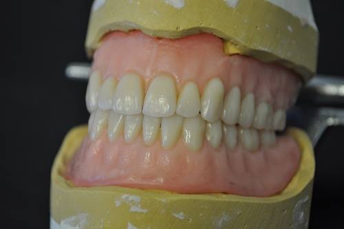 Custom dentures at McCall Denture.