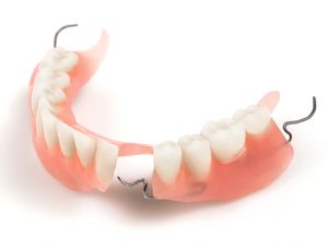 dentures