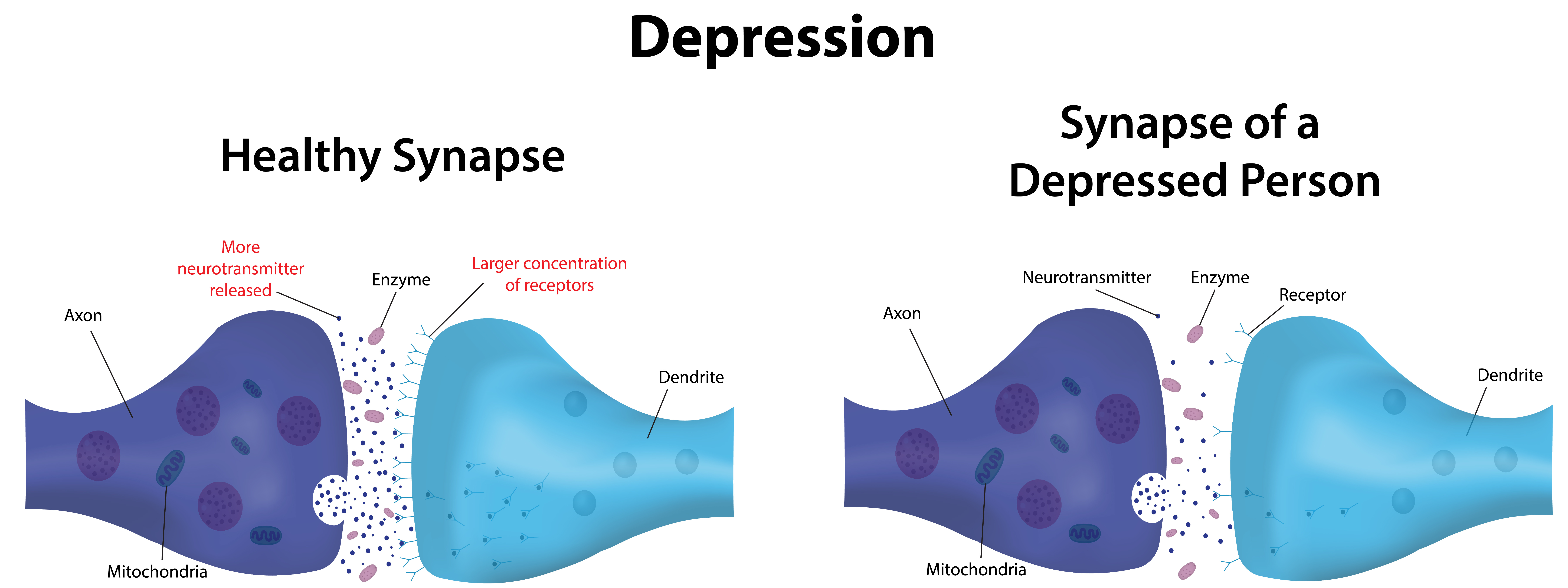 othercide synapse difficulty