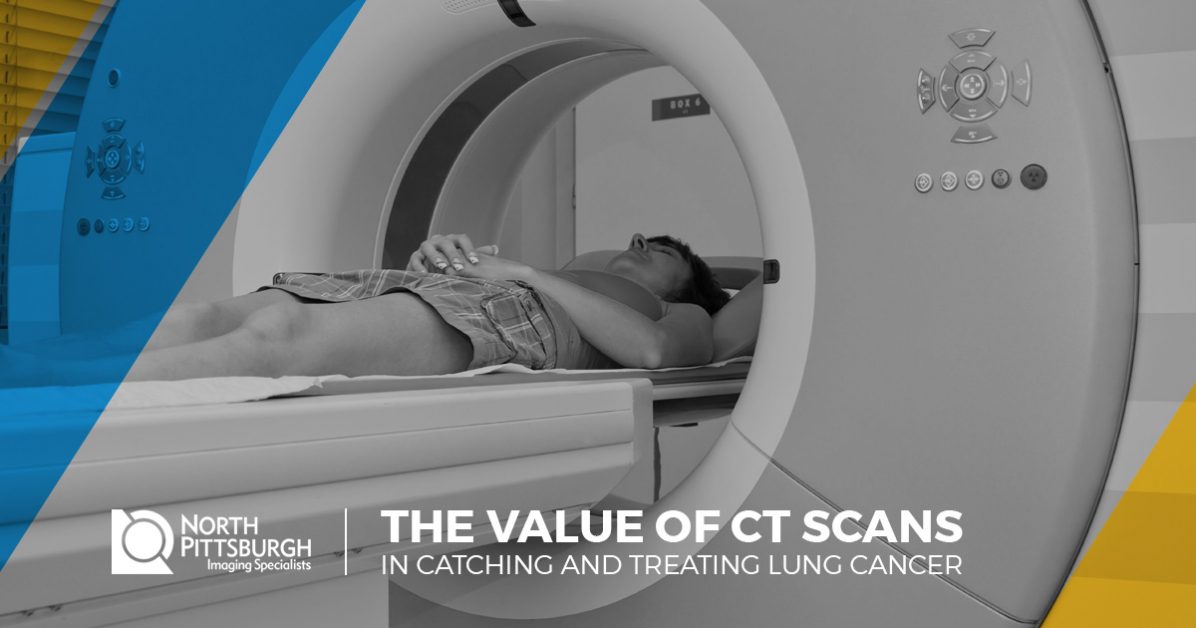 Pittsburgh CT The Value of CAT Scans In Detecting Lung Cancer