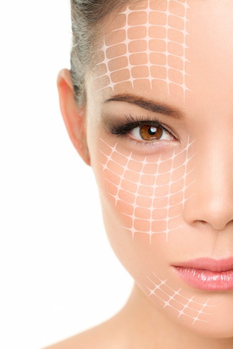 facelift