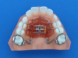 orthodontic appliances