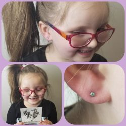 Ear piercings with 18 gauge internally threaded AB 3 millimeter tops.