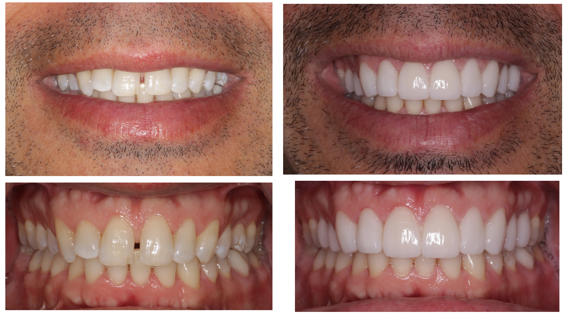 Cosmetic Dentistry Ballston Spa Dental Office Malta Dentistry NY