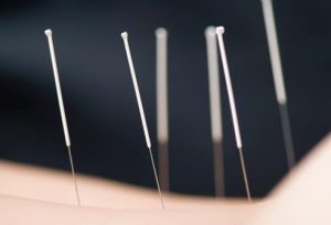 You don't need to suffer! Acupuncture treatment can make a big difference for menstrual pain.