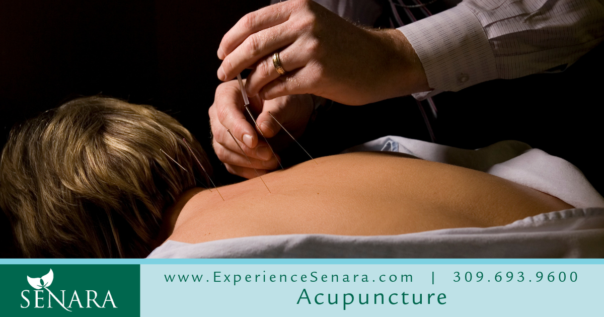 Acupuncture Experience Natural Pain Relief And Care Senara Health And Healing Center Spa