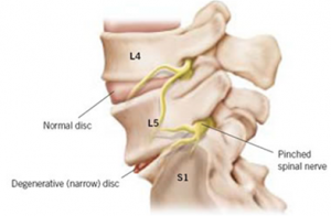 spinal6
