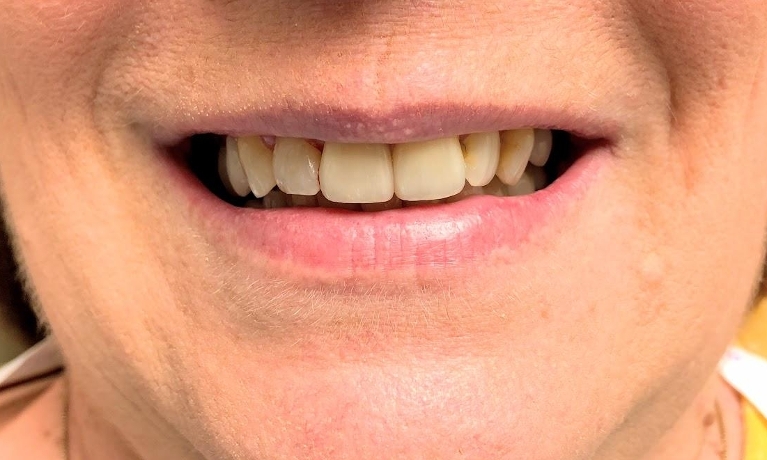 Valley Ridge Dental - Family Dentist In Lake Elmo - All Your Dental Needs