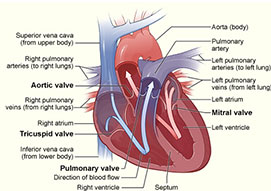 Mitral/Aortic Valvuloplasty