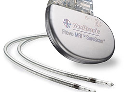 Pacemaker Implantation