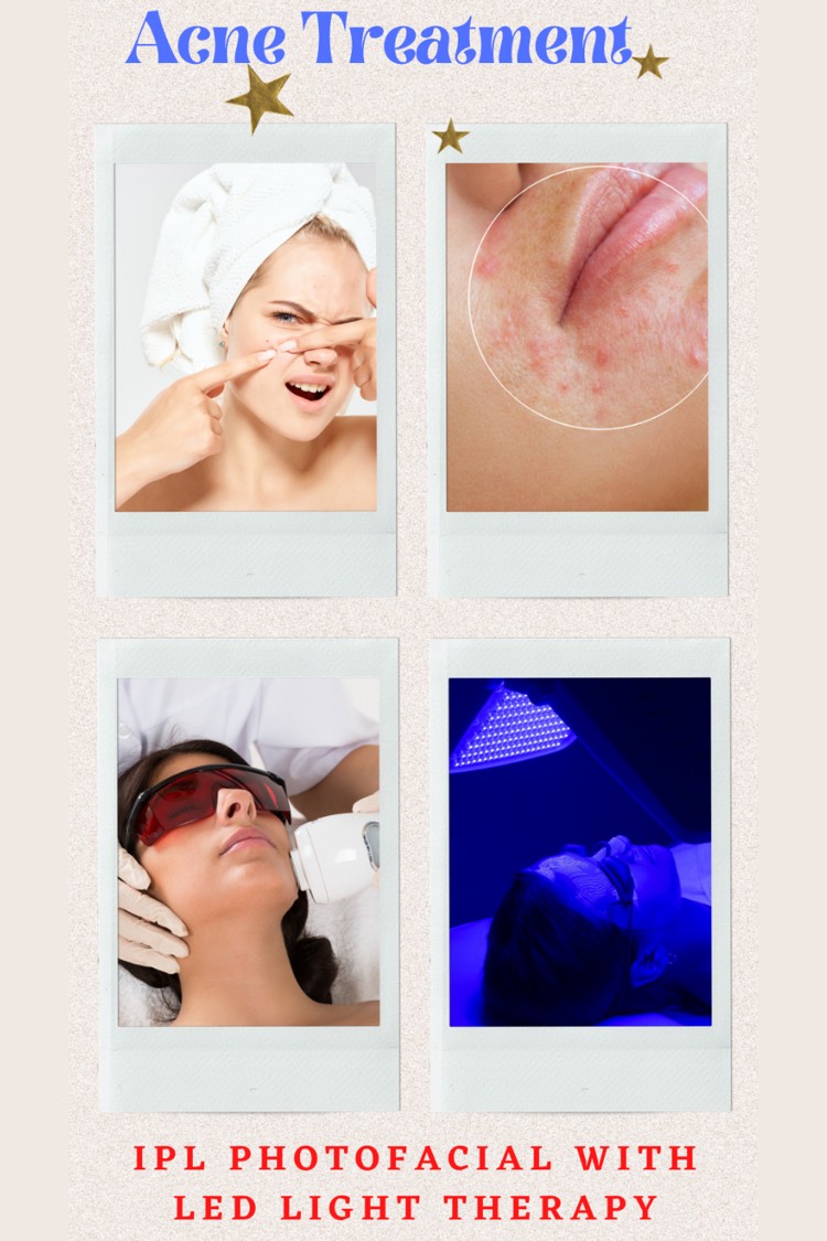 Microdermabrasion Smithtown Laser Hair Removal NY Beauty Spa 11787