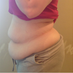 AMANDA BEFORE